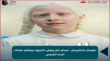 مهرجان مانشيستر.. حسام داغر يعرض «البينو» ويكشف معاناة أعداء الشمس